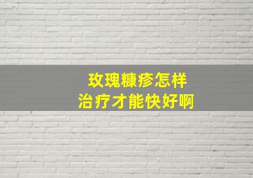 玫瑰糠疹怎样治疗才能快好啊