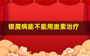 银屑病能不能用激素治疗