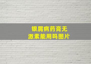 银屑病药膏无激素能用吗图片